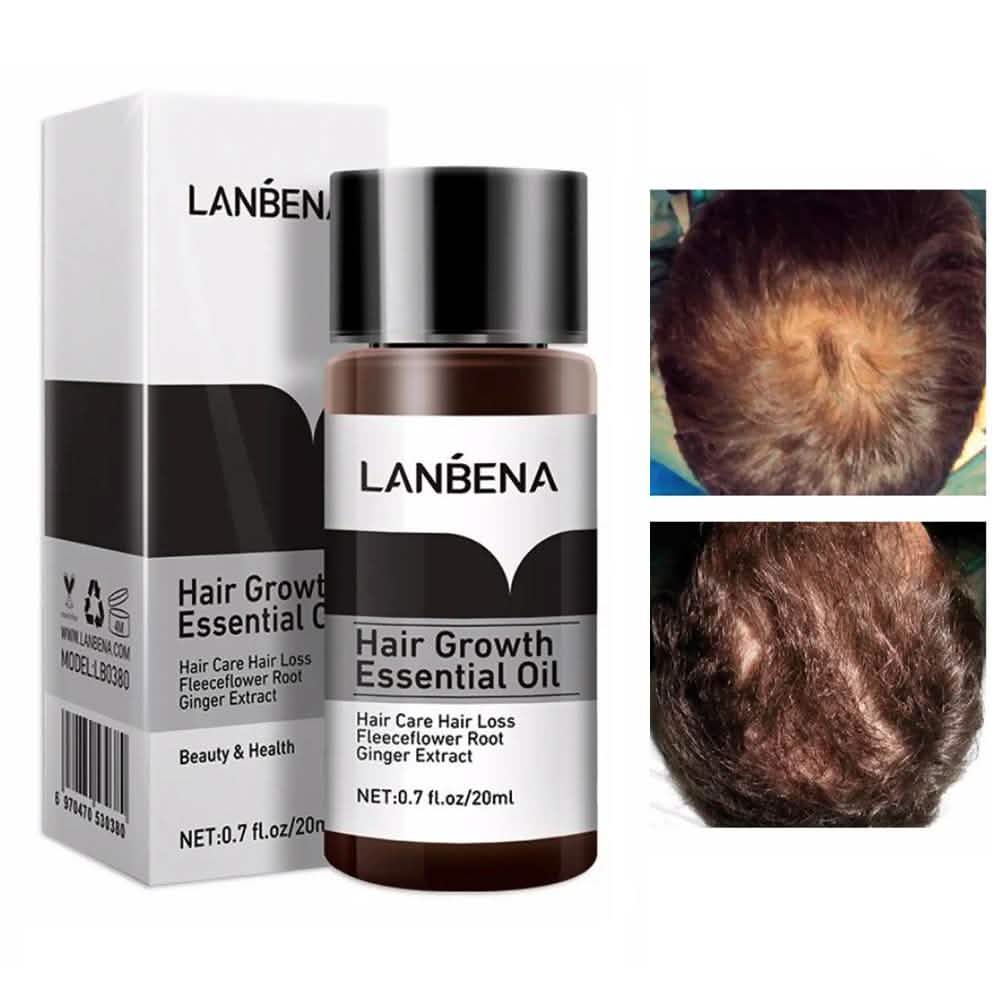 Aceite Esencial Para el Crecimiento del Cabello y Tratamiento de la Caída del Cabello Para Hombres y Mujeres