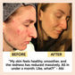 Kaolin Clay Face Mask