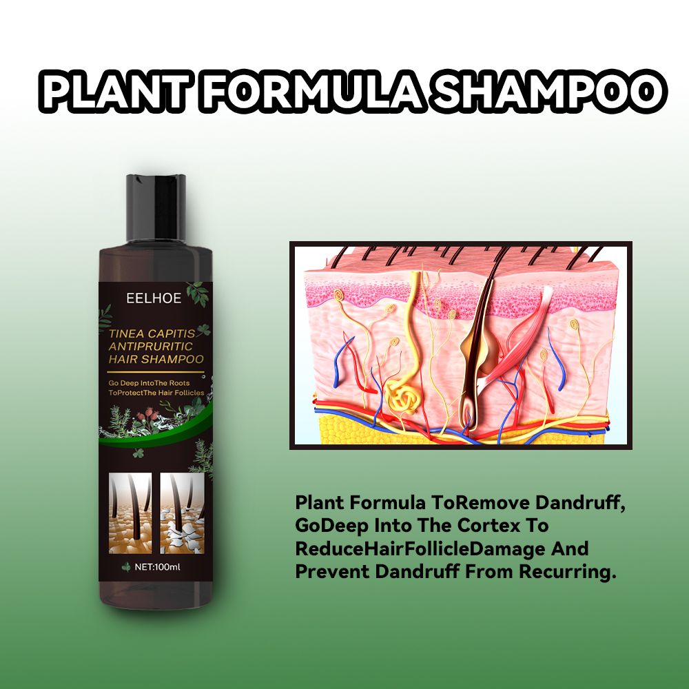 Champú anticaspa, Champú para cuero cabelludo propenso a foliculitis, dermatitis, caspa, picazón y descamación, Trata la caspa y la dermatitis seborreica, Champú antipicazón