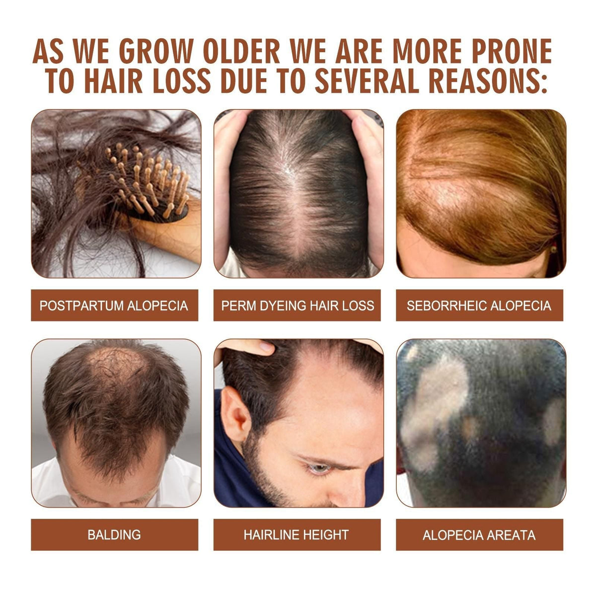 Aceite de Batana de Honduras - Consigue un Cabello Más Abundante, Grueso y Saludable - Excelentes Regalos para Mujeres Hombres Acondicionador Cuidado del Cabello Sedoso - Nutrición Capilar