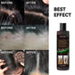 EELHOE Champú Anticaspa - Alivio de la picazón, Prevención de la caída del cabello, Control de la grasa y Cuidado refrescante
