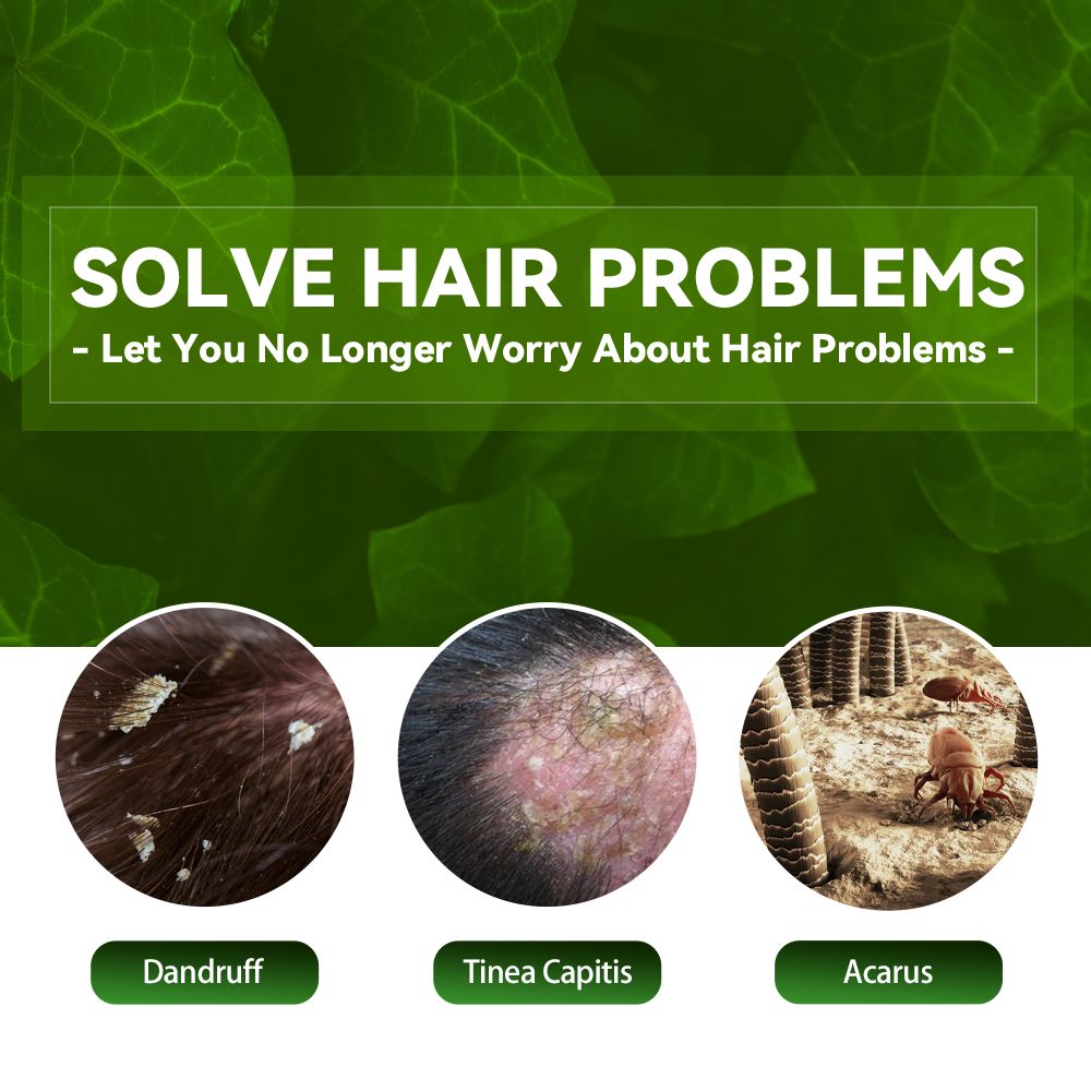 Champú anticaspa, Champú para cuero cabelludo propenso a foliculitis, dermatitis, caspa, picazón y descamación, Trata la caspa y la dermatitis seborreica, Champú antipicazón