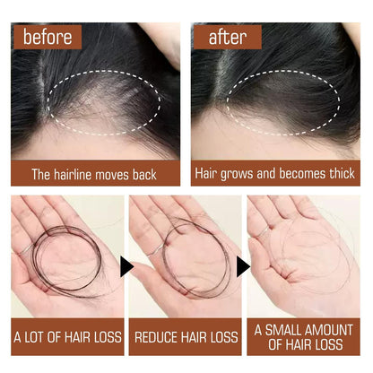 Aceite de Batana de Honduras - Consigue un Cabello Más Abundante, Grueso y Saludable - Excelentes Regalos para Mujeres Hombres Acondicionador Cuidado del Cabello Sedoso - Nutrición Capilar