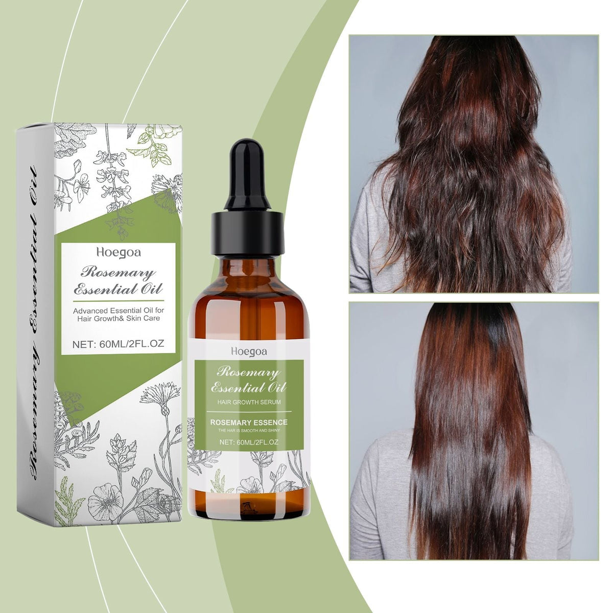 El aceite esencial capilar de romero de Hoegoa repara el cabello dañado, nutre el cuero cabelludo, fortalece el cabello y mejora las puntas abiertas