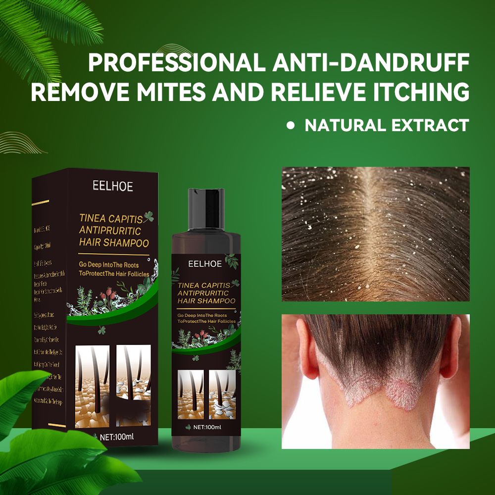 Champú anticaspa, Champú para cuero cabelludo propenso a foliculitis, dermatitis, caspa, picazón y descamación, Trata la caspa y la dermatitis seborreica, Champú antipicazón