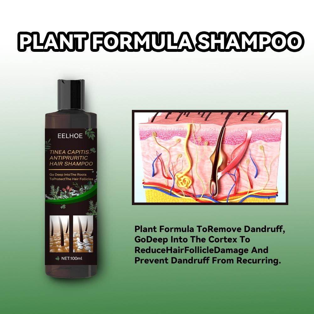 EELHOE Champú Anticaspa - Alivio de la picazón, Prevención de la caída del cabello, Control de la grasa y Cuidado refrescante
